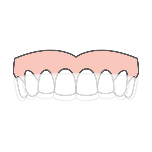 Réalignement des dents par gouttières invisibles
